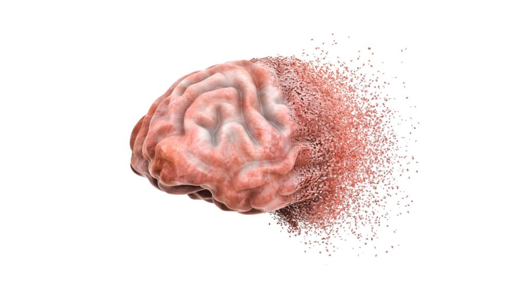 A picture of a brain which is crumbling at the front, showing that EMDR Therapy can help with stress and Anxiety.